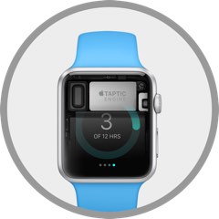 Apple Watch mostrando componentes internos, indicando servicio especializado de reparación de Apple Watch en Santifer iRepair